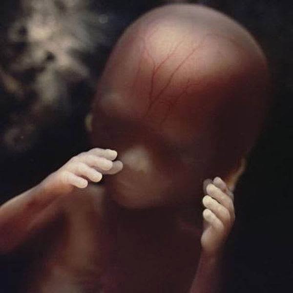 16-saptamani-odiseea-sarcinii-fetus-dezvoltat